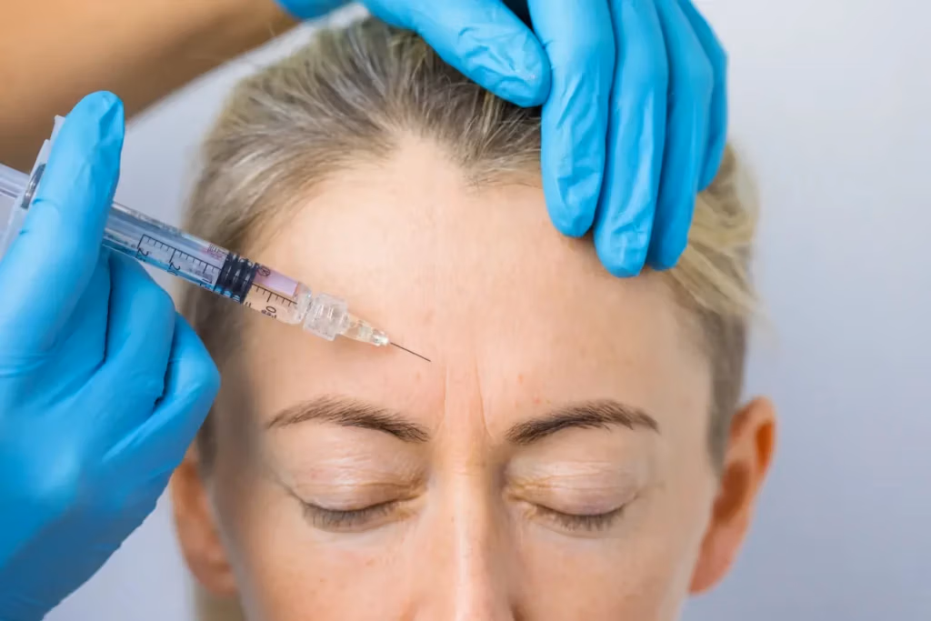 clinician wearing gloves injects syringe into woman’s forehead while she keeps eyes closed